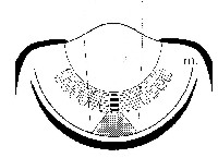 fig6-3TN.jpg Concave Mirror Eye Diagram 200x145
